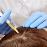A Useful PRP Consultation Starts With One Concern, Not a Makeover